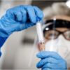 Variante Omicron, in Germania immunità guariti ridotta a 3 mesi