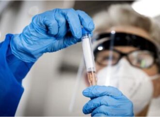 Variante Omicron, in Germania immunità guariti ridotta a 3 mesi