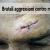 Croazia: torture e brutali aggressioni contro migranti