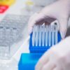 Trovato gene legato a Long Covid, setacciati Dna di migliaia pazienti