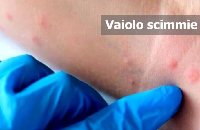 Oms: Vaiolo scimmie, “è emergenza sanitaria globale”