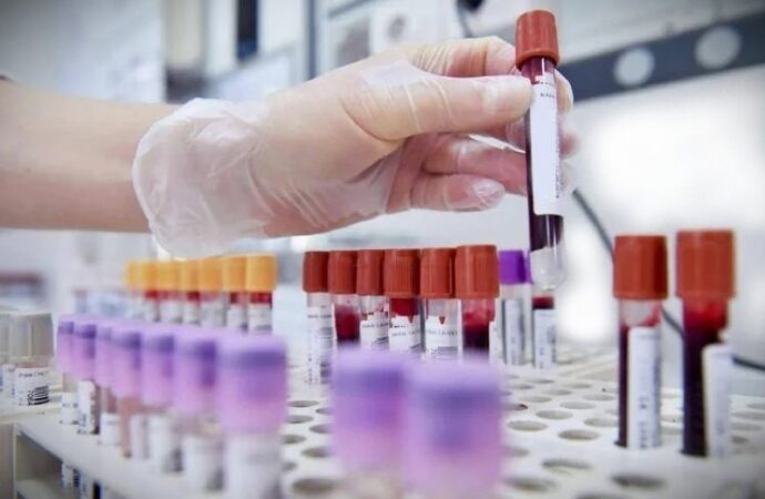 Alert difterite, l’infezione continua a colpire in Europa