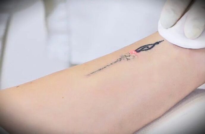 Tatuaggi pericolosi? L’effetto sul sistema immunitario e i rischi: lo studio